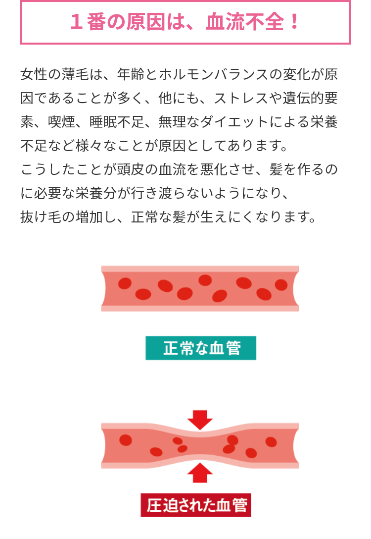 １番の原因は、血流不全！