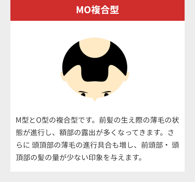 MO複合型